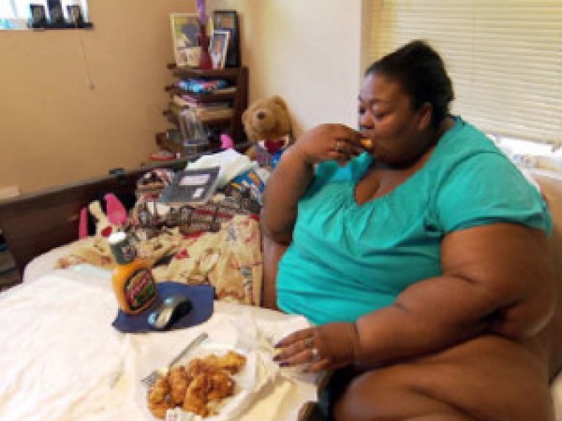 Obesity-pic-300x225-mscrzxa9i3s3j3heoay31x0630vq6c32dv9pvj3ii8
